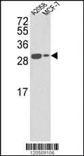 Anti-APRT Rabbit Polyclonal Antibody