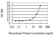 Anti-MPP2 Mouse Monoclonal Antibody [clone: 2B1]