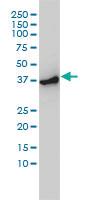 Anti-ACTR2 Mouse Monoclonal Antibody [clone: 1B10-C4]