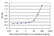 Anti-LTBR Polyclonal Antibody Pair