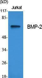 Western blot analysis of various cells using Anti-BMP-2 Antibody