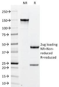 SDS-PAGE analysis of Anti-PLGF Antibody [PLGF/94] under non-reduced and reduced conditions; showing intact IgG and intact heavy and light chains, respectively. SDS-PAGE analysis confirms the integrity and purity of the Antibody