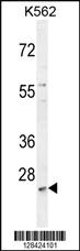 Anti-SLC25A52 Rabbit Polyclonal Antibody