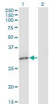 Anti-RAD1 Mouse Monoclonal Antibody [clone: 1A12]