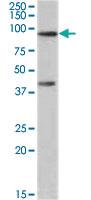 Anti-ABCB5 Goat Polyclonal Antibody