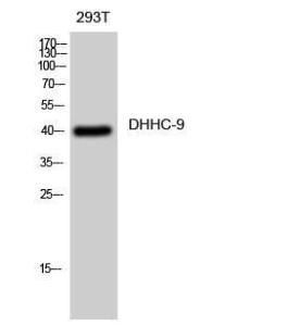 Western blot analysis of 293T cells using Anti-ZDHHC9 Antibody