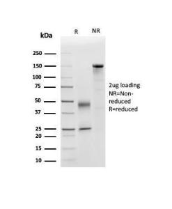 SDS-PAGE analysis of Anti-Apolipoprotein D Antibody [APOD/3415] under non-reduced and reduced conditions; showing intact IgG and intact heavy and light chains, respectively. SDS-PAGE analysis confirms the integrity and purity of the antibody