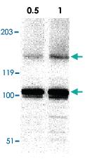 Anti-IKBKAP Rabbit Polyclonal Antibody