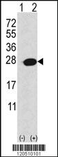 Anti-APRT Rabbit Polyclonal Antibody