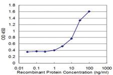 Anti-RAD1 Mouse Monoclonal Antibody [clone: 1A12]