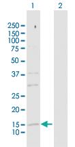 Anti-SRP19 Rabbit Polyclonal Antibody