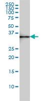 Anti-SDSL Mouse Monoclonal Antibody [clone: M2]