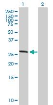 Anti-ASB7 Mouse Polyclonal Antibody