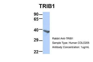 Anti-TRIB1 Rabbit Polyclonal Antibody