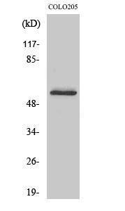 Western blot analysis of COLO205 cells using Anti-GLR Antibody