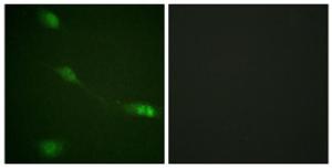 Immunofluorescence analysis of NIH/3T3 cells using Anti-MDM2 Antibody. The right hand panel represents a negative control, where the antibody was pre-incubated with the immunising peptide.