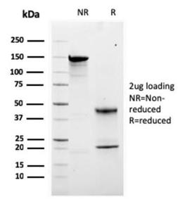 SDS-PAGE analysis of Anti-Calretinin Antibody [CALB2/2807] under non-reduced and reduced conditions; showing intact IgG and intact heavy and light chains, respectively. SDS-PAGE analysis confirms the integrity and purity of the antibody