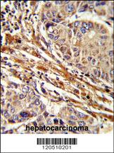 Anti-APRT Rabbit Polyclonal Antibody