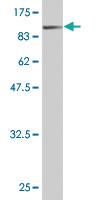 Anti-BFSP1 Mouse Monoclonal Antibody [clone: 1B11]