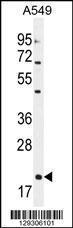 Anti-EDN1 Rabbit Polyclonal Antibody