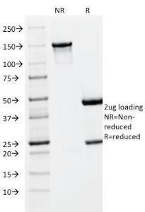 Anti-PLGF Mouse Monoclonal Antibody [clone: PLGF/93]