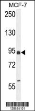 Anti-EFHB Rabbit Polyclonal Antibody