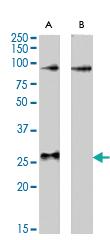 Anti-APOBEC2 Goat Polyclonal Antibody