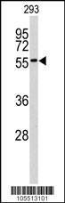 Anti-MKNK2 Rabbit Polyclonal Antibody (AP (Alkaline Phosphatase))