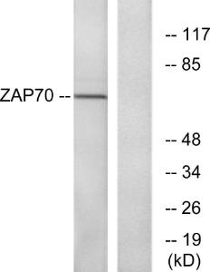 Western blot analysis of lysates from Jurkat cells using Anti-ZAP-70 Antibody. The right hand lane represents a negative control, where the antibody is blocked by the immunising peptide