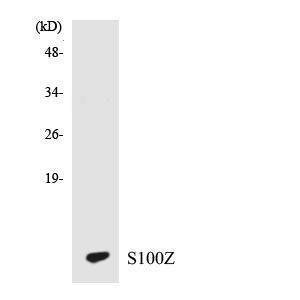 Western blot analysis of the lysates from HT 29 cells using Anti-S100Z Antibody