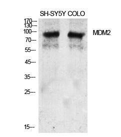 Western blot analysis of various cells using Anti-MDM2 Antibody