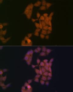 Immunofluorescence analysis of HeLa cells using Anti-Kaiso Antibody [ARC2086] (A306238) at a dilution of 1:100 (40X lens). DAPI was used to stain the cell nuclei (blue)