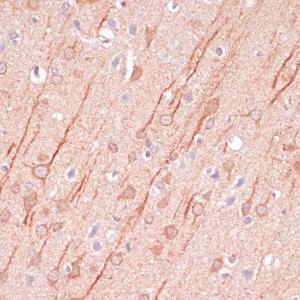 Immunohistochemistry analysis of paraffin-embedded rat brain using Anti-SAP102 Antibody (A93210) at a dilution of 1:100 (40X lens)