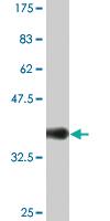 Anti-SNCG Mouse Monoclonal Antibody [clone: 2C3]