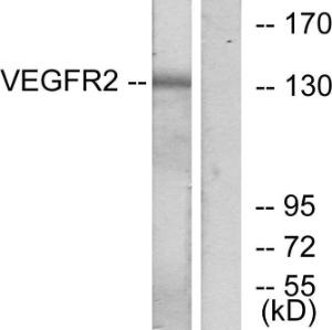 Western blot analysis of lysates from K562 cells, treated with LPS 100 ng/ml 30' using Anti-VEGFR2 Antibody. The right hand lane represents a negative control, where the antibody is blocked by the immunising peptide