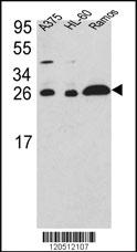 Anti-ARHGDIA Rabbit Polyclonal Antibody