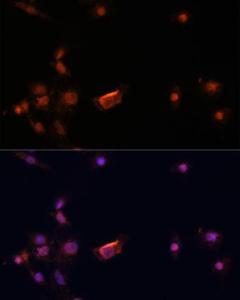 Immunofluorescence analysis of C6 cells using Anti-BRCA2 Antibody (A9045) at a dilution of 1:100. DAPI was used to stain the cell nuclei (blue)