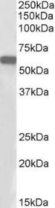 Anti-E2F1 Antibody (A85158) (1 µg/ml) staining of HeLa nuclear lysate (35 µg protein in RIPA buffer). Primary incubation was 1 hour. Detected by chemiluminescence