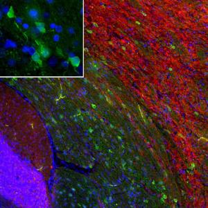 Anti-PEA15 antibody