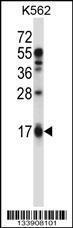 Anti-EDN2 Rabbit Polyclonal Antibody (HRP (Horseradish Peroxidase))