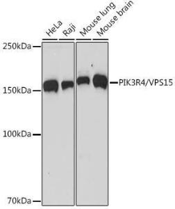 Anti-VPS15 antibody