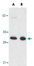 Anti-TNFRSF13B Rabbit Polyclonal Antibody