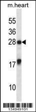 Anti-MXI1 Rabbit Polyclonal Antibody (APC (Allophycocyanin))