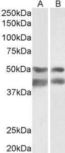 Anti-E2F4 Antibody (A85159) (0.003 µg/ml) staining of Pig Brain (A) and Heart (B) lysates (35 µg protein in RIPA buffer). Primary incubation was 1 hour. Detected by chemiluminescence