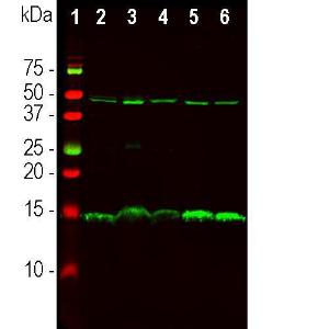 Anti-PEA15 antibody