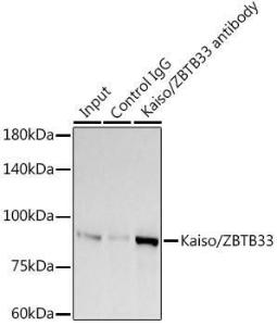 Immunoprecipitation analysis of 300 µg extracts of A-549 cells using 3 µg of Anti-Kaiso Antibody [ARC2086] (A306238). This Western blot was performed on the immunoprecipitate using Anti-Kaiso Antibody [ARC2086] (A306238) at a dilution of 1:1000