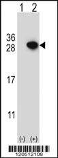 Anti-ARHGDIA Rabbit Polyclonal Antibody