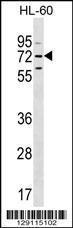 Anti-MBTD1 Rabbit Polyclonal Antibody