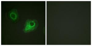 Immunofluorescence analysis of HeLa cells using Anti-VEGFR2 Antibody. The right hand panel represents a negative control, where the antibody was pre-incubated with the immunising peptide