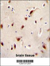 Anti-IQCJ Rabbit Polyclonal Antibody